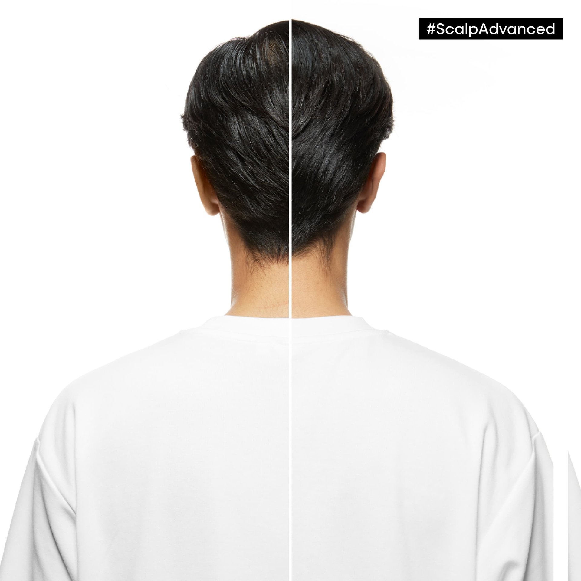 block-serie-expert-refills-2025-06-before-after-5
